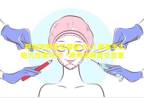 呼和浩特爱贝国际 🦉 美容丰太阳穴效果对比「呼和浩特爱贝蕊恩国际月子中心」